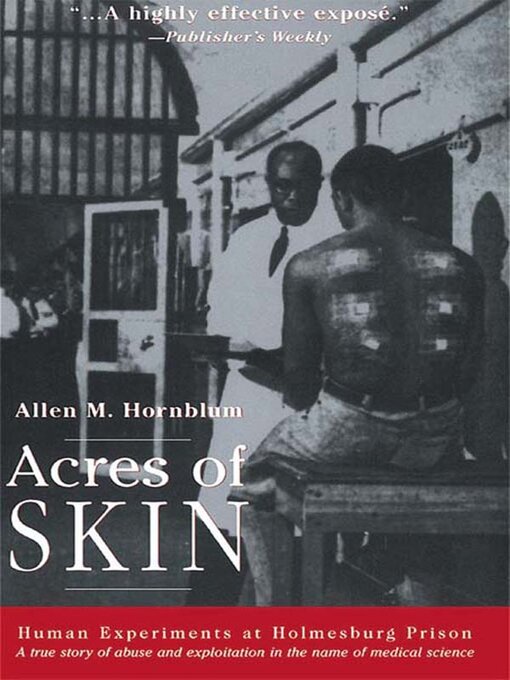 Title details for Acres of Skin by Allen M. Hornblum - Available